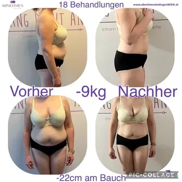 Vorher-Nachher-Vergleich einer Kundin